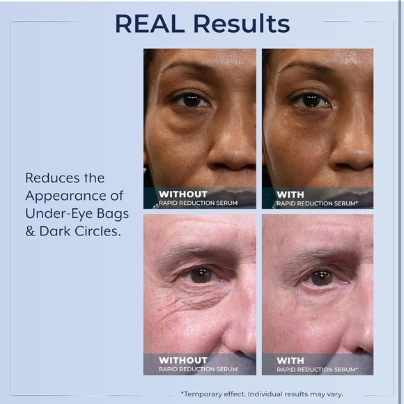 2 Plexaderm Rapid Reduction Advanced Serum AS SEEN ON TV's Best Selling Skincare - Picture 13 of 15